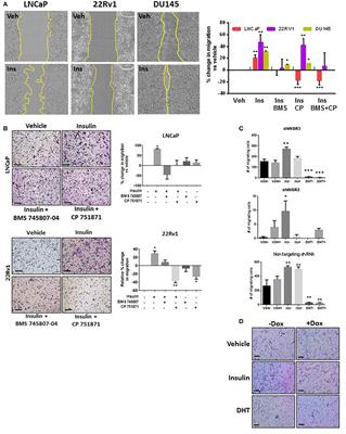 Insulin Enhances Migration and Invasion in Prostate Cancer Cells by Up-Regulation of FOXC2